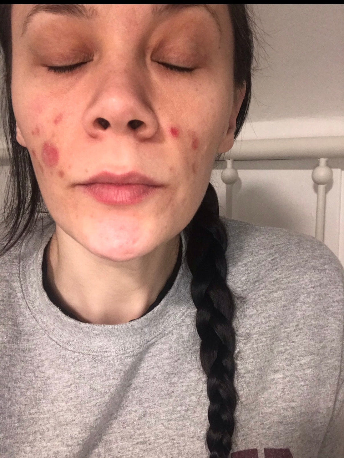 Why I Made the Collagen Soap Face Bar: My Journey from Skin Chaos to 40 and Thriving